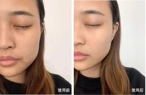 抗皱好？让肌肤焕发新生J9九游会哪种护肤品(图4)