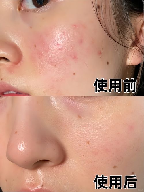霜十大适合追求年轻肌肤的人j9九游会网址是什么抗皱面(图6)